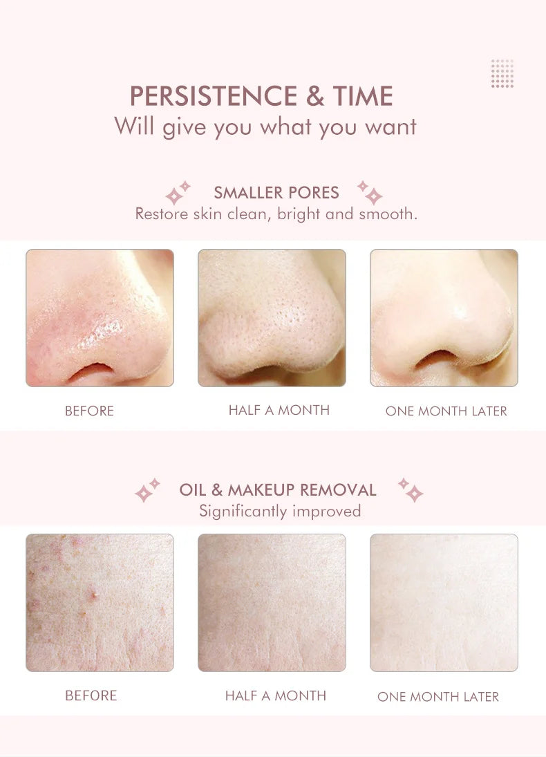 Ultrasonic Skin Scrubber Electric Facial Cleansing Pore Deep Cleanser Acne Blackhead Remover Peeling Shovel Beauty Machine