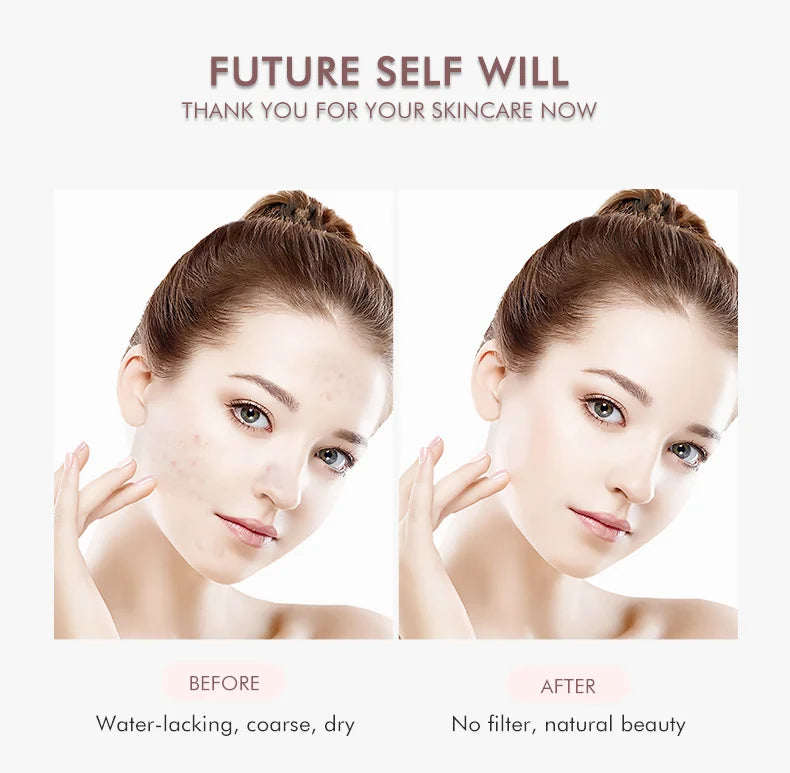 Ultrasonic Skin Scrubber Electric Facial Cleansing Pore Deep Cleanser Acne Blackhead Remover Peeling Shovel Beauty Machine