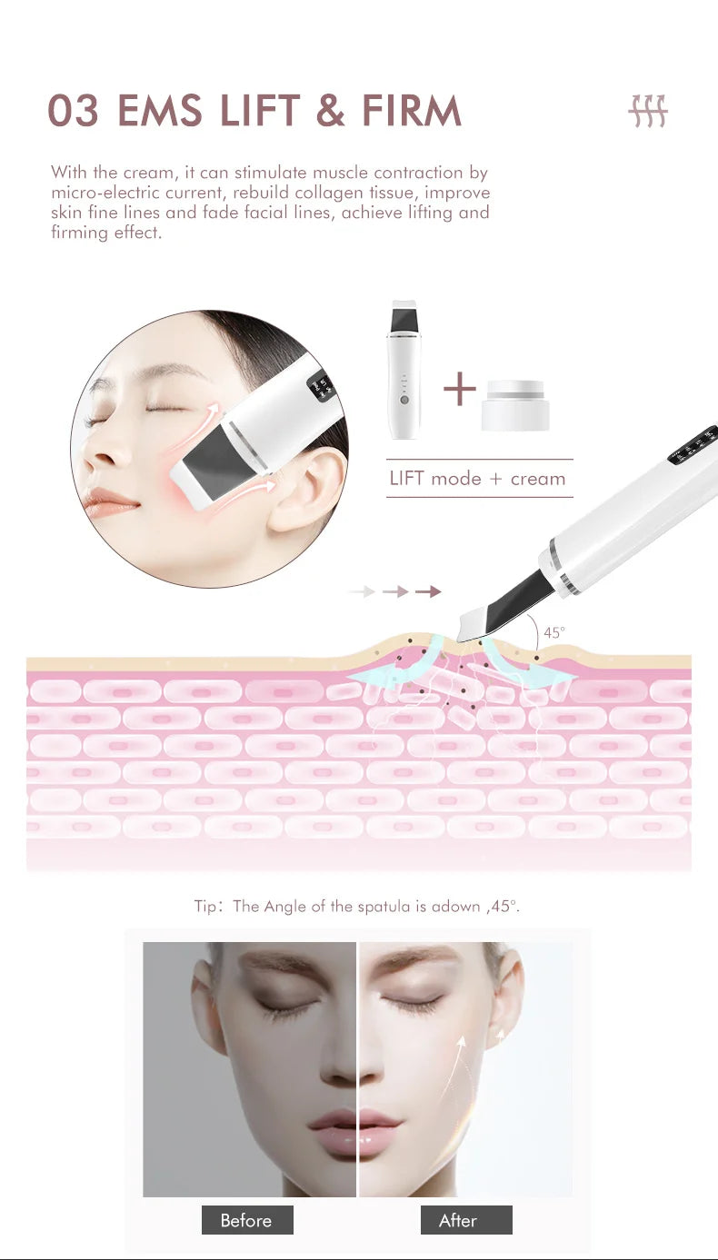 Ultrasonic Skin Scrubber Electric Facial Cleansing Pore Deep Cleanser Acne Blackhead Remover Peeling Shovel Beauty Machine