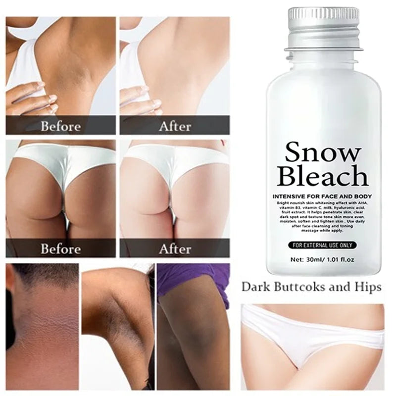 Body Whitening Cream Brighten Skin Underarm Knee Buttocks Private Parts Bleach Inner Thighs Intimate Area Remove Melanin  Care