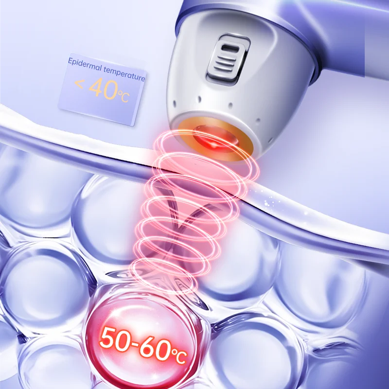 Mini Ultrasonic Face Lifting Device Deeply Stimulates SMAS Layer for V-Line Shaping Wrinkle Removal & Anti-Aging Painless Facial