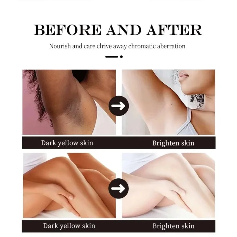 Body Whitening Cream Brighten Skin Underarm Knee Buttocks Private Parts Bleach Inner Thighs Intimate Area Remove Melanin  Care